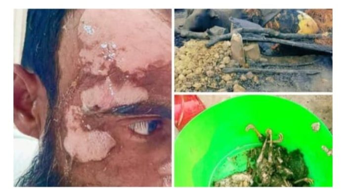 হিজলা দুর্বৃত্তদের দেওয়া আগুনে জলসে গেল গোয়ালঘর বাঁচাতে গিয়ে নিজেই অগ্নিদগ্ধ ।